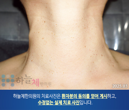 피부질환