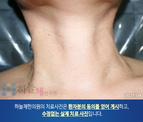 피부질환