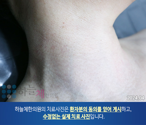 피부질환