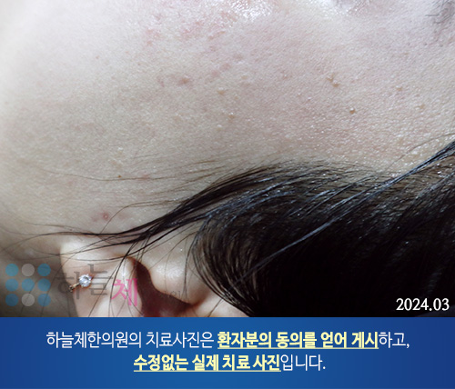 피부질환