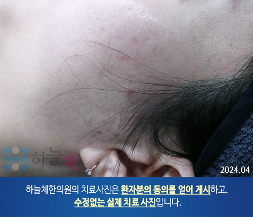 피부질환