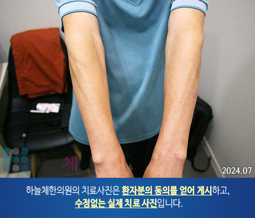 피부질환